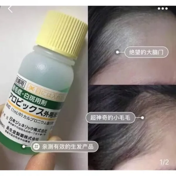 日本处方生发水2